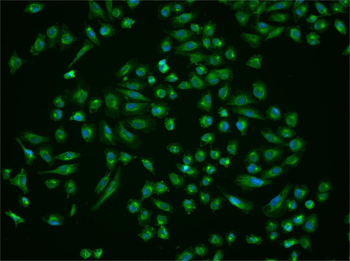 CORO7 Rabbit Polyclonal Antibody