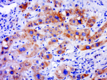 CORO7 Rabbit Polyclonal Antibody