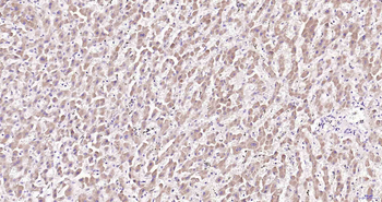 ERPINA6/Cortisol Binding Globulin Rabbit Polyclonal Antibody