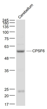 CPSF6 Rabbit Polyclonal Antibody