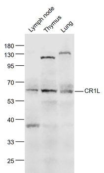 CR1L Rabbit Polyclonal Antibody