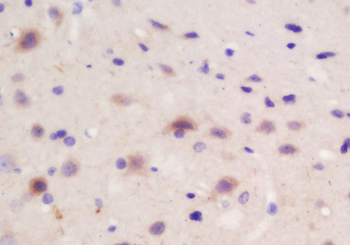 CRB2 Rabbit Polyclonal Antibody
