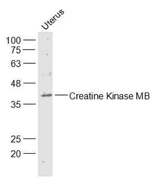 Creatine Kinase MB Rabbit Polyclonal Antibody