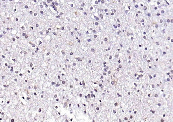 CREB5 Rabbit Polyclonal Antibody