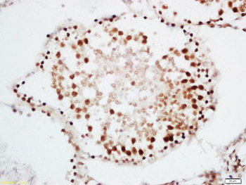 CRNKL1 Rabbit Polyclonal Antibody