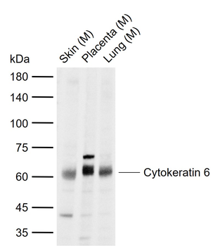 Cytokeratin 6 Rabbit Polyclonal Antibody