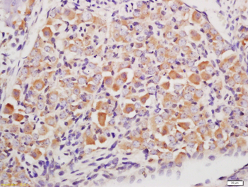 Cytokeratin 6 Rabbit Polyclonal Antibody