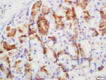 Cytokeratin 6 Rabbit Polyclonal Antibody