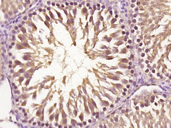 CRYGB Rabbit Polyclonal Antibody