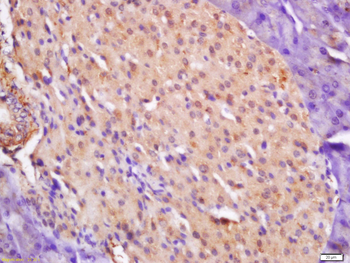 CTDSP2 Rabbit Polyclonal Antibody