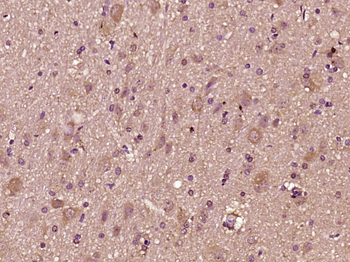 CTTNBP2 Rabbit Polyclonal Antibody
