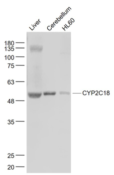 CYP2C18 Rabbit Polyclonal Antibody