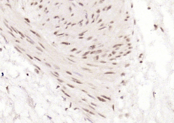 Cytokeratin 2e Rabbit Polyclonal Antibody
