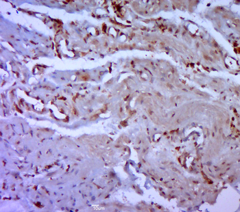 Cytokeratin 9 Rabbit Polyclonal Antibody