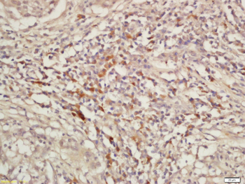 KIF11 Rabbit Polyclonal Antibody