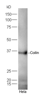 Coilin Rabbit Polyclonal Antibody