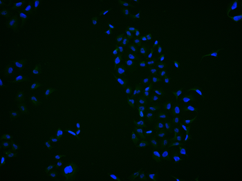 CBX4 Rabbit Polyclonal Antibody