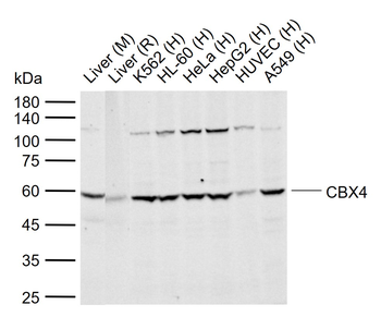 CBX4 Rabbit Polyclonal Antibody