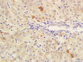 CES1/Liver Carboxylesterase 1 Rabbit Polyclonal Antibody