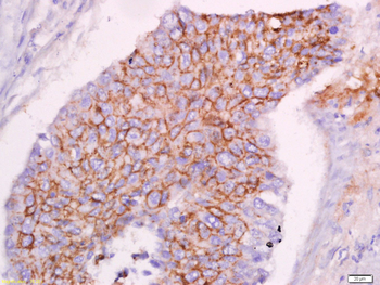 CLEC16A Rabbit Polyclonal Antibody