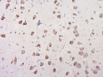 DDX1 Rabbit Polyclonal Antibody