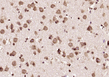 DDX17 Rabbit Polyclonal Antibody