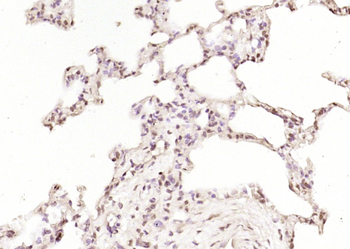 DDX17 Rabbit Polyclonal Antibody