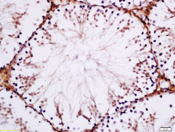 DDX21 Rabbit Polyclonal Antibody