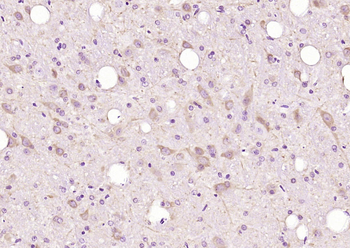 DDX41 Rabbit Polyclonal Antibody