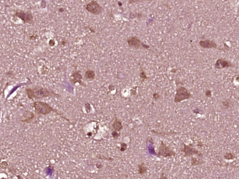 DEFB112 Rabbit Polyclonal Antibody