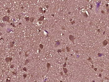 DEFB124 Rabbit Polyclonal Antibody