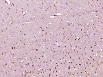 Deltex Rabbit Polyclonal Antibody