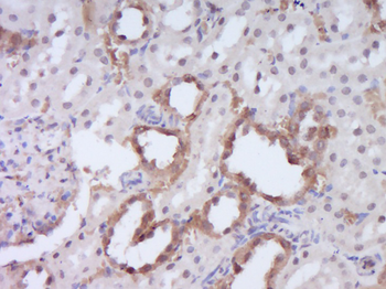 DENND4B Rabbit Polyclonal Antibody