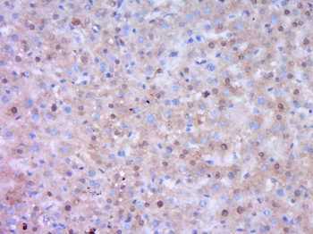 DENND4B Rabbit Polyclonal Antibody