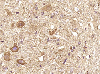 DGKA Rabbit Polyclonal Antibody