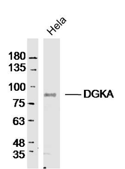 DGKA Rabbit Polyclonal Antibody