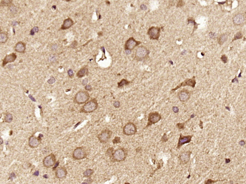 DGKZ Rabbit Polyclonal Antibody