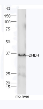 DHDH Rabbit Polyclonal Antibody