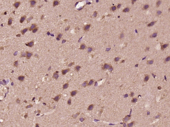 DHX37 Rabbit Polyclonal Antibody