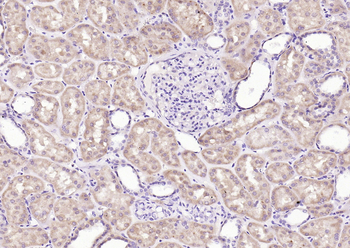 DIP2B Rabbit Polyclonal Antibody