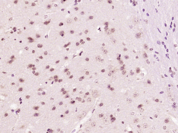 DIP2B Rabbit Polyclonal Antibody