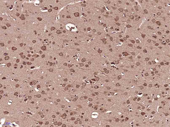 DIP2B Rabbit Polyclonal Antibody