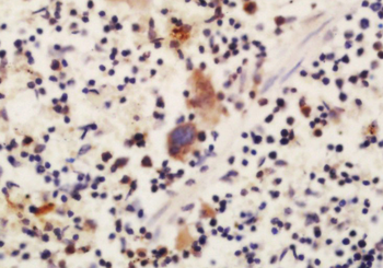 DLC1 + DLC2 Rabbit Polyclonal Antibody