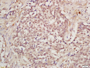 DNA Polymerase epsilon p59 Rabbit Polyclonal Antibody