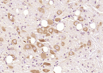 DNAJC2 Rabbit Polyclonal Antibody