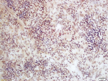 DNAJC2 Rabbit Polyclonal Antibody