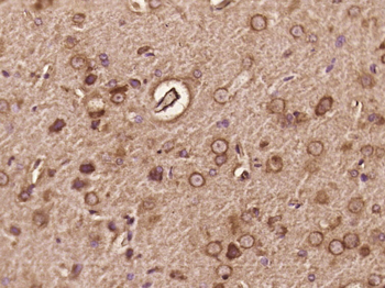 DOC2B Rabbit Polyclonal Antibody