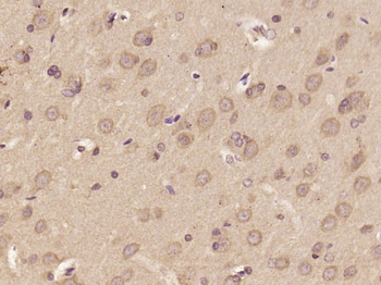 DOLPP1 Rabbit Polyclonal Antibody