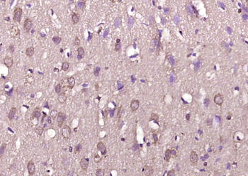 DOPEY1 Rabbit Polyclonal Antibody