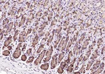 DTX3L Rabbit Polyclonal Antibody